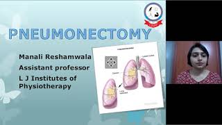 Pneumonectomy by Dr Manali RehamwalaPT [upl. by Lehcyar103]