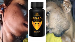 Permanent Beard Growth Results  Redensyl Beard Growth Serum  Best Beard Oil 2023 [upl. by Squier]