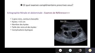 néphrologie polykystose rénale [upl. by Nnylorac]