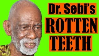 Dr Sebis Rotten Teeth [upl. by Balcer]