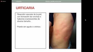 Urticaria Angiedema y Eritema Multiforme  Medicina III [upl. by Russi]