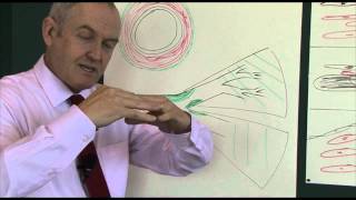 Heart disease 6 Pathophysiology of coronary heart disease [upl. by Eidda]