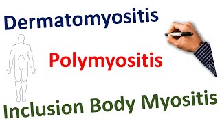 Dermatomyositis Polymyositis Inclusion Body Myositis STEP NCLEX COMLEX [upl. by Refiffej]