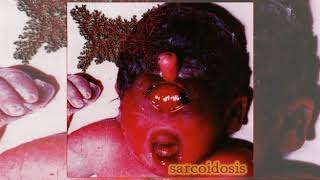 Viscera Infest – Sarcoidosis [upl. by Bastian631]