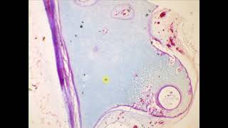 Hyaline cartilage Hyaline cartilage Special stain [upl. by Oryaj805]