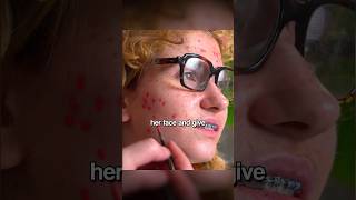 Anxious Teen Had So Much Acne So She Had A Makeover 💄 [upl. by Notfa]