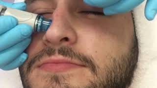 MENS SKIN CARE TRUECARE HYDRAFACIAL MD [upl. by Liagaba]