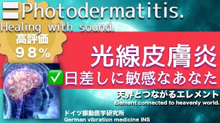 ✅光線皮膚炎 日差しに敏感なあなた〓Photodermatitis Relax amp Healing music with Dr Rife [upl. by Yllime111]