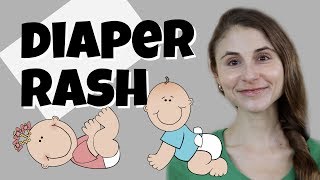 DIAPER RASH TIPS amp TRICKS FROM A DERMATOLOGIST DR DRAY [upl. by Cleveland]