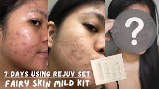 FAIRY SKIN MILD SET 7 DAYS RESULT  Honest Review 2024 My Acne Journey [upl. by Pacien858]