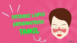 Systemic Lupus Erythematosus SLE in Tamil Definition Symptoms Causes Diagnosis and Management [upl. by Ellehcal30]