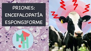 ‼️PRIONES y la Encefalopatía Espongiforme [upl. by Vallery]