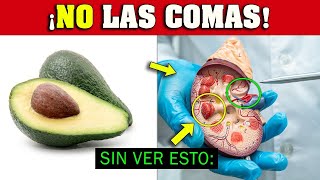 ¡ALERTA quienes NO DEBERÍAN Comer AGUACATE 🥑 Palta ⛔ [upl. by Selrhc]