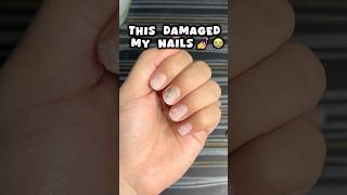 Nail extensions ki galti 😭😭nails nailsextension viralvideo shortsfeed viralshort trending [upl. by Morgana]