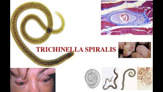 Triquinella spiralis [upl. by Celina187]