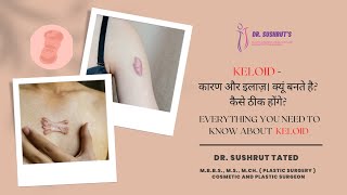 Everything you need to know about Keloid  Explained By Plastic Surgeon  Dr Sushrut Tated keloid [upl. by Nehtanoj449]