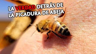 Qué hacer Cuando TE PICA una ABEJA en la MANO  Remedios Caseros para Picadura de Abeja [upl. by Korie164]