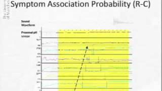 Acoustic Cough Reflux Associations in Chronic Cough [upl. by Nodnek56]