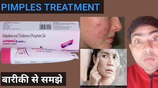 acnesol a nano gel use in hindi [upl. by Eves]