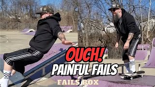 Broken Bones amp PAINFUL Fails  Fails Compilation [upl. by Aramas]