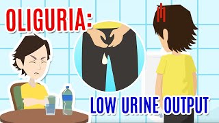 Oliguria poor urine production Causes diagnosis and care [upl. by Aronoh]