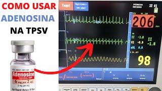 O que fazer na Taquicardia Supraventricular paroxística [upl. by Annis]