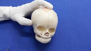 Foetal skull and difference of male and female skullosteology [upl. by Horlacher]