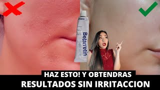 TRETINOINA RETINOL Y ADAPALENO SIN IRRITACION Las Mejor Crema Contra MANCHAS y ARRUGAS Kelly Perez [upl. by Acitel]