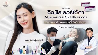 🚩ตูน พิมพ์ปวีณ์ โคกระบินทร์ ดารานักแสดง ไว้วางใจให้ Amarante clinic ฉีดฟิลเลอร์ใต้ตา [upl. by Gerrit]