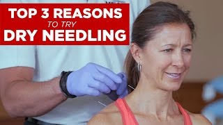 Top 3 Reasons to Try Dry Needling [upl. by Rome]