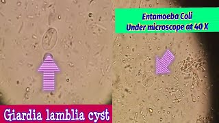 Difference between Giardia Lamblia amp Entamoeba Coli cystBest view under microscope at 40 X [upl. by Mellins]