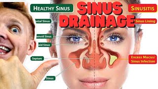 Natural sinus drainage swollen lymph nodes blocks the passage tutorial [upl. by Aredna]