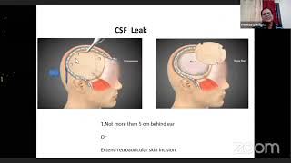 Decompressive Craniectomy  complications and avoidance [upl. by Dannica]