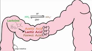 Hepatic Encephalopathy and Lactulose [upl. by Sochor]