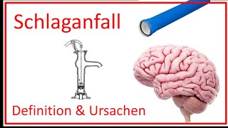 Schlaganfall  Definition und Ursachen [upl. by Clarabelle183]