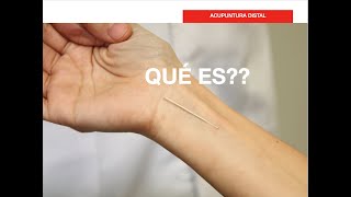 Qué es la ACUPUNTURA DISTAL [upl. by Assetal]