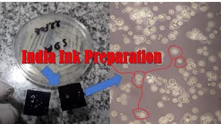 India Ink Preparation from culture of Cryptococcus neoformans [upl. by Eekaz]