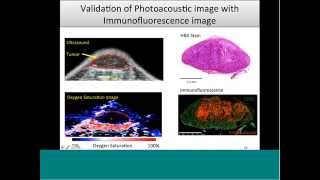 October 2015 Webinar  Clinically Translatable Cancer Research with Photoacoustic Imaging [upl. by Trillbee]