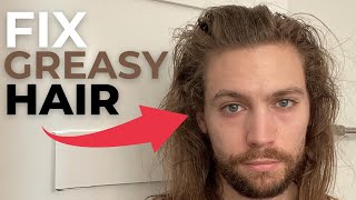 7 Tips To FIX GREASY OILY Scalp [upl. by Chuah514]