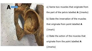 Posterior thigh and Popliteal Fossa Anatomy Anatomy revision with questions and answers [upl. by Sinnej]