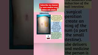 JejunostomyFreeMedicalEducationld3sfviralmedicalviralshortsvideoyoutubeviralshortsnursing [upl. by Magocsi]