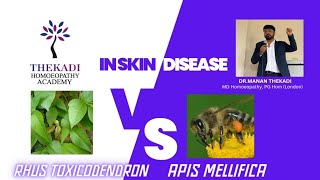 Rhus toxicodendron vs Apis mellifica in skin diseases [upl. by Adaynek]