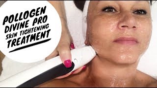 Pollogen Divine Pro Rejuvenating Tightening Treatment Vlog [upl. by Adnawot768]