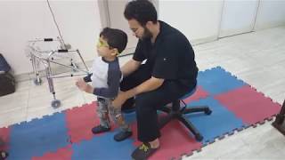 طريقة مميزة لتحسين المشي لحالة شلل دماغي  Gait training Cerebral palsy [upl. by Farlee286]