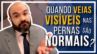 🔴 Veias visíveis nas pernas Quando são NORMAIS [upl. by Atilrep554]