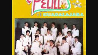 BANDA PELILLOSLA BILIRRUBINA [upl. by Poppo]