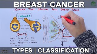 Breast Cancer and its types [upl. by Kilam]