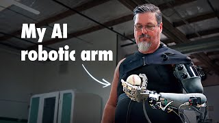 Theyre Building Him an AI Powered Robotic Arm [upl. by Tormoria]