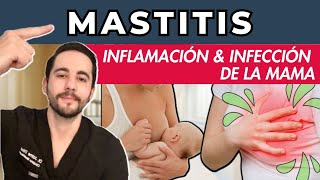 MASTITIS  Inflamación e Infección de la Mama  Qué es Lactancia Causas Tratamiento [upl. by Asihtal844]