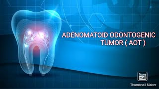 AOT  ADENOMATOID ODONTOGENIC TUMOR  Adenoameloblastoma [upl. by Bannister176]